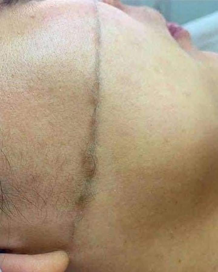 شفرات ترينا للوجه